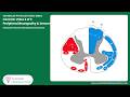 2/6 video- Peripheral Neuropathy: Clinical Features & Bedside Assessment