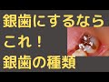 保険の銀歯も選べます！【現役歯科医師が解説】