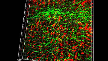 Intravital imaging of mouse liver