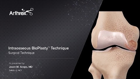 Intraosseous BioPlasty™ Technique
