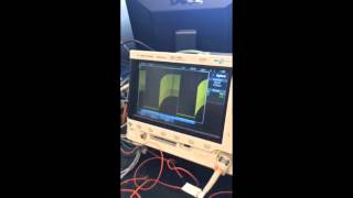 Hindmarsh-Rose Neural Model Simulation