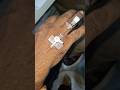 IV cannula technique video part 87#video #ivcatheter #hospital