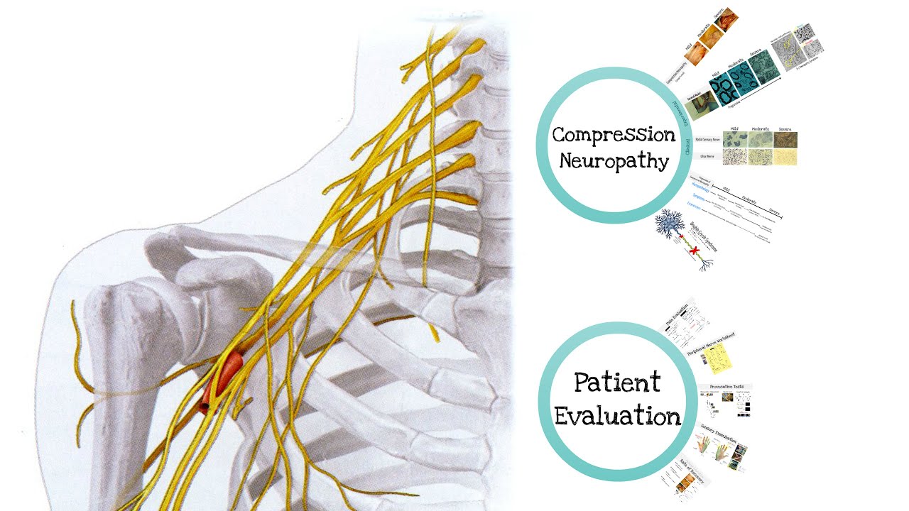 Introduction To Compression Neuropathies Feat Dr Mackinnon Youtube