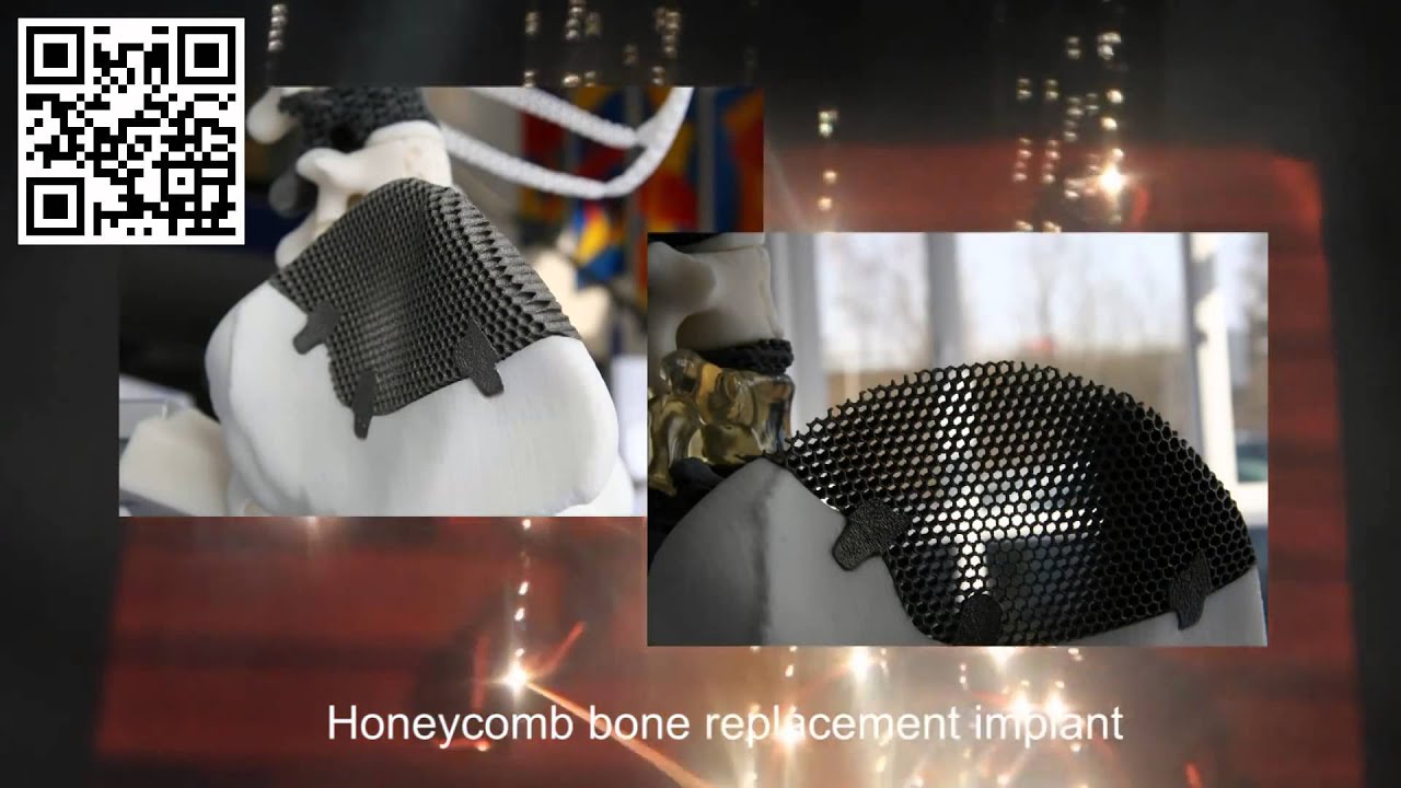 Titanium 3D Printing in Action Electron Beam Melting EBM - YouTube