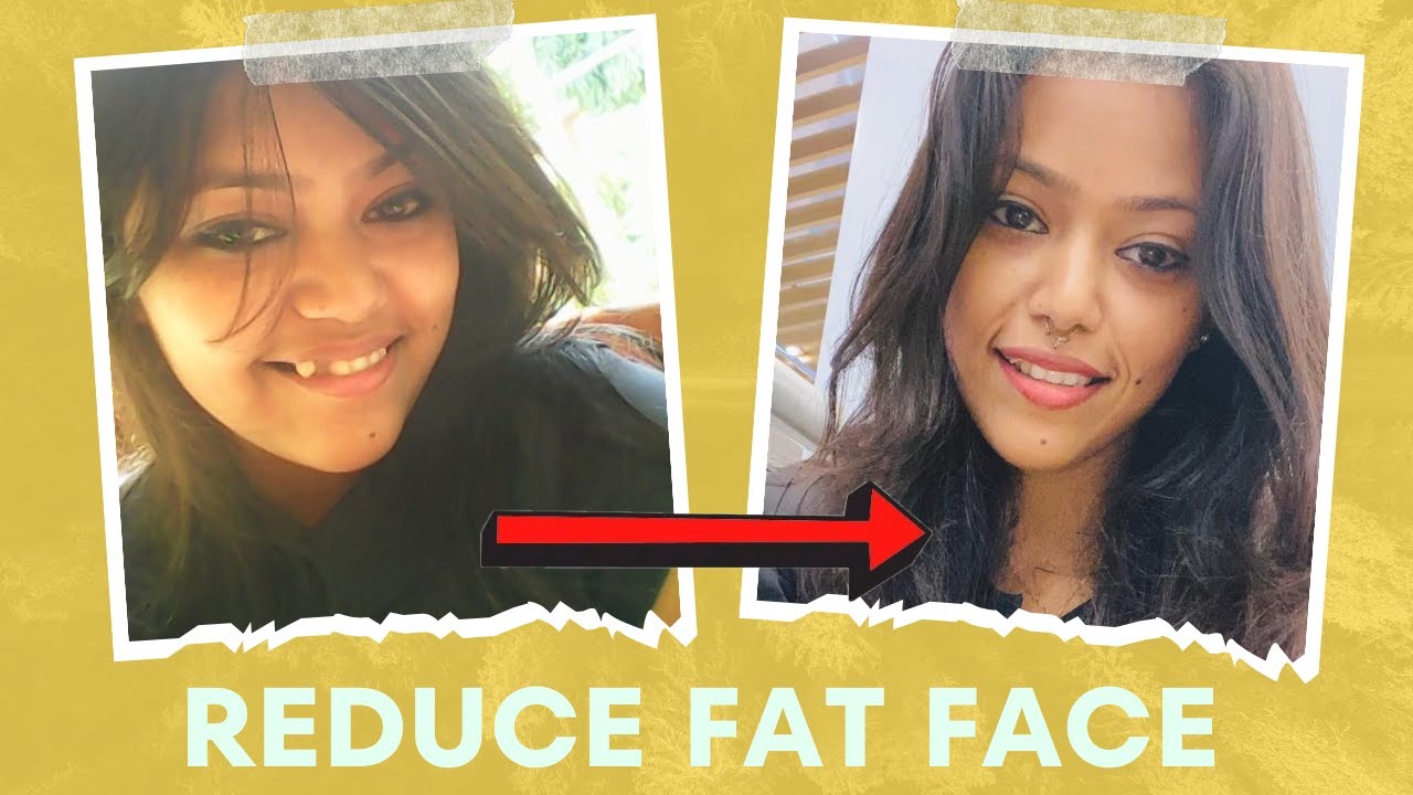 Face Fat reduction is easy |  चेहरे की चर्बी कम करे