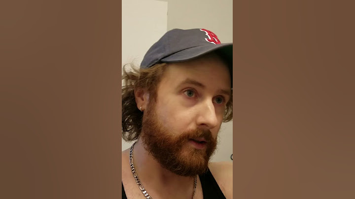 INCREDIBLE NEW LOOK 👀 For This Balding Man
