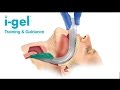 i-gel® supraglottic airway from Intersurgical: an introduction