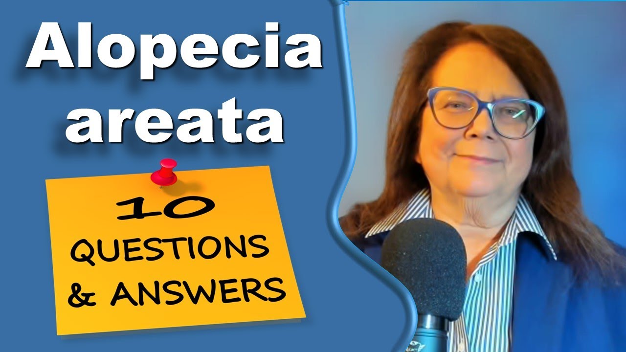 10 вопросов и ответов о гнездной алопеции