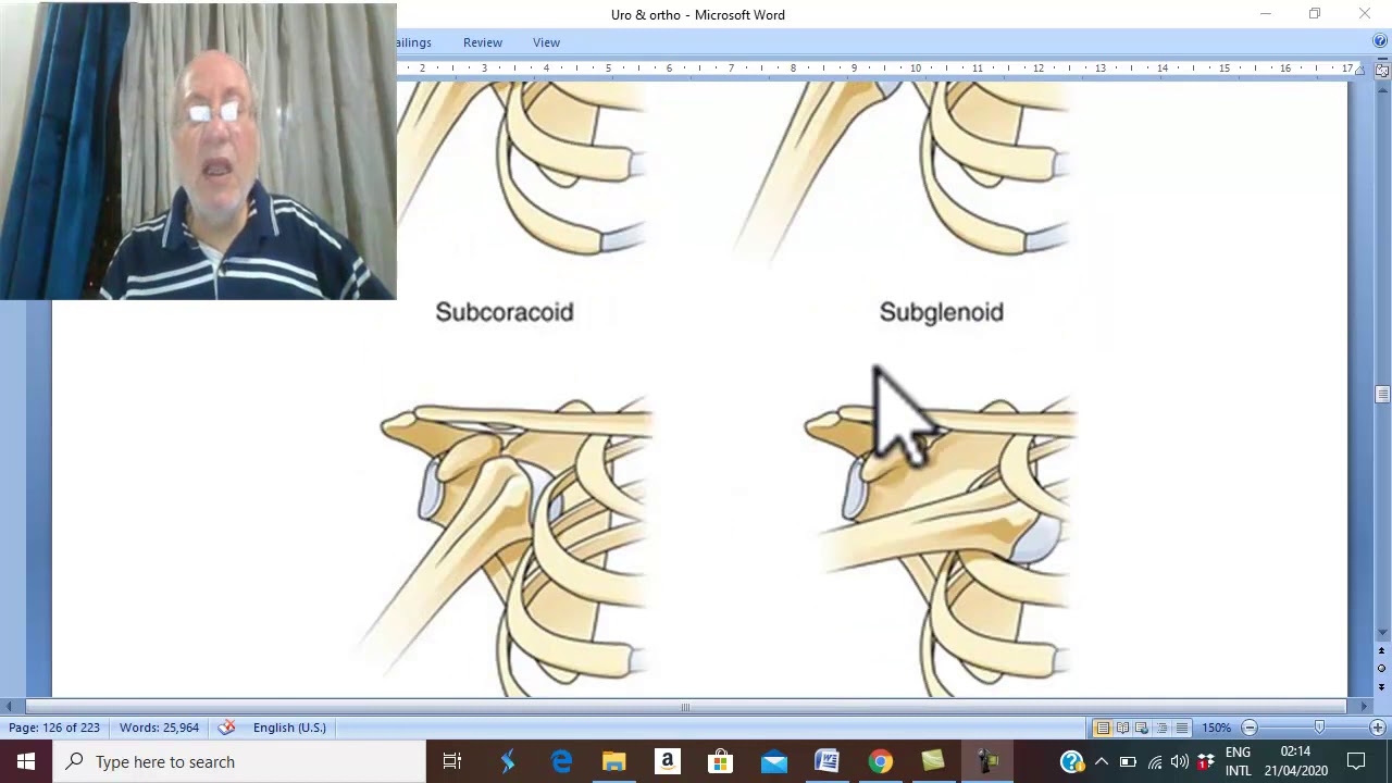 Orthopedic in Arabic 12 (  Dislocation  of  shoulder joint ) , by  Dr. Wahdan .