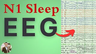 N1 Brainwaves in Sleep on EEG Explained: Vertex Waves, POSTs Wealth