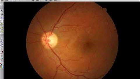 IMACAM TRAINING VIDEO