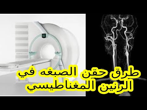طرق حقن الصبغه الماده الملونه في الرنين المغناطيس       