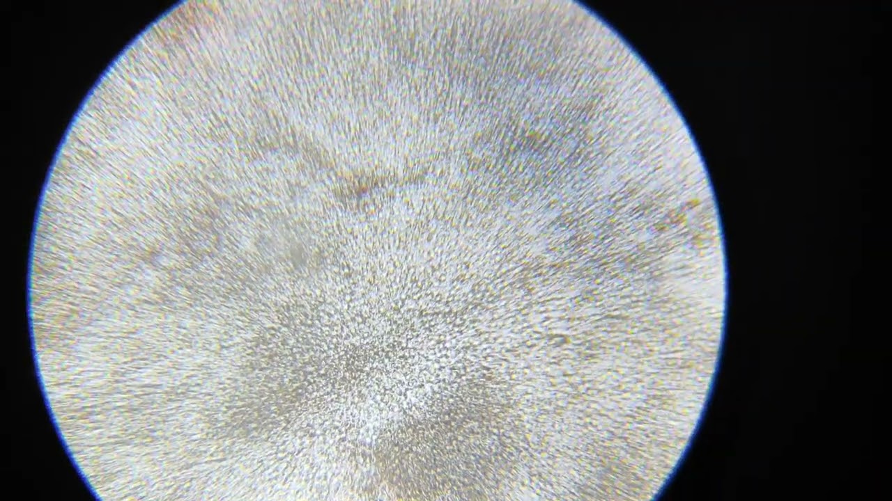 Сопли под микроскопом