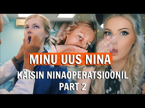 Video: Lina esimene plastiline kirurgia - nina korrigeerimine