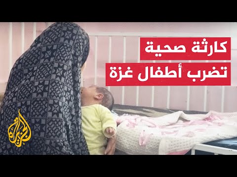 كارثة صحية جديدة تضرب أطفال غزة.. 35 حالة حمى شوكية في مجمع ناصر