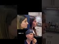 Dr. Richard Reish - Primary Rhinoplasty 1 year post-op