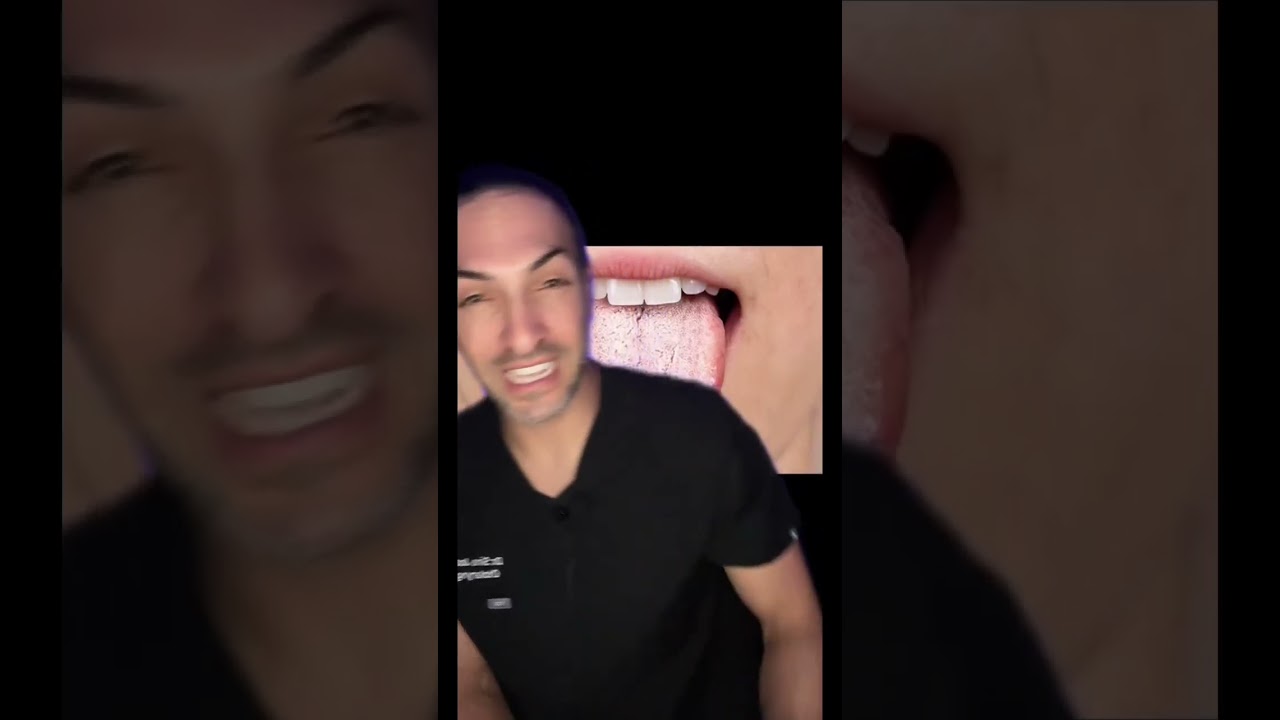 Do you Snore? Look for these 3 things in your throat to find out