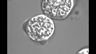 Juraj Kabat Feeding Entamoeba Histolytica