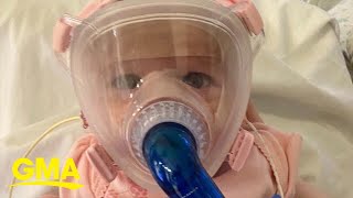 6-month-old survived COVID-19 after having open-heart surgery l GMA Digital