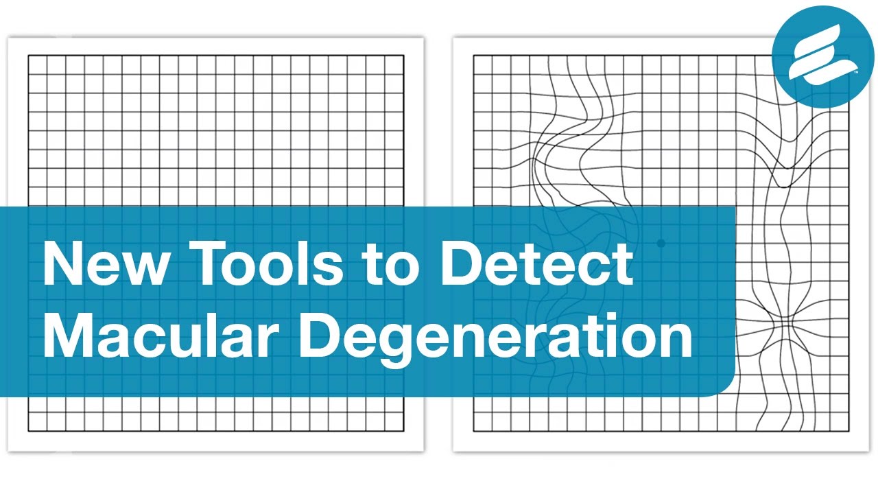 Amsler Chart to Test Your Sight  American Macular Degeneration Foundation