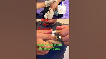 Finger Dislocation reduction | #athleictrainer #sportsmedicine @worldfederationofathletict4050
