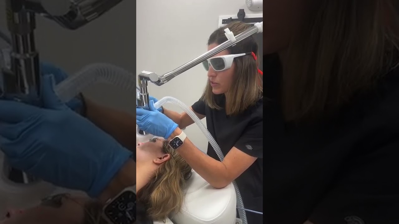 Nano Laser Peel at Revitalize U Med Spa & Salon