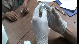 How to Perform a Proper Thick and Thin Smear for Malaria Diagnosis