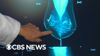 FDA plans new mammogram regulations to support women with dense breasts