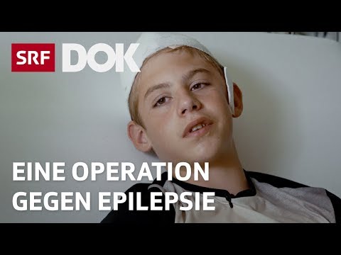 Video: Wie Bekomme Ich Eine Behinderung Mit Epilepsie?