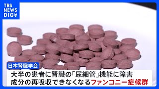 紅麹成分含むサプリ　大半が「ファンコニー症候群」日本腎臓学会調査 4分の3ほどはサプリの服用の中止で症状が改善｜TBS NEWS DIG