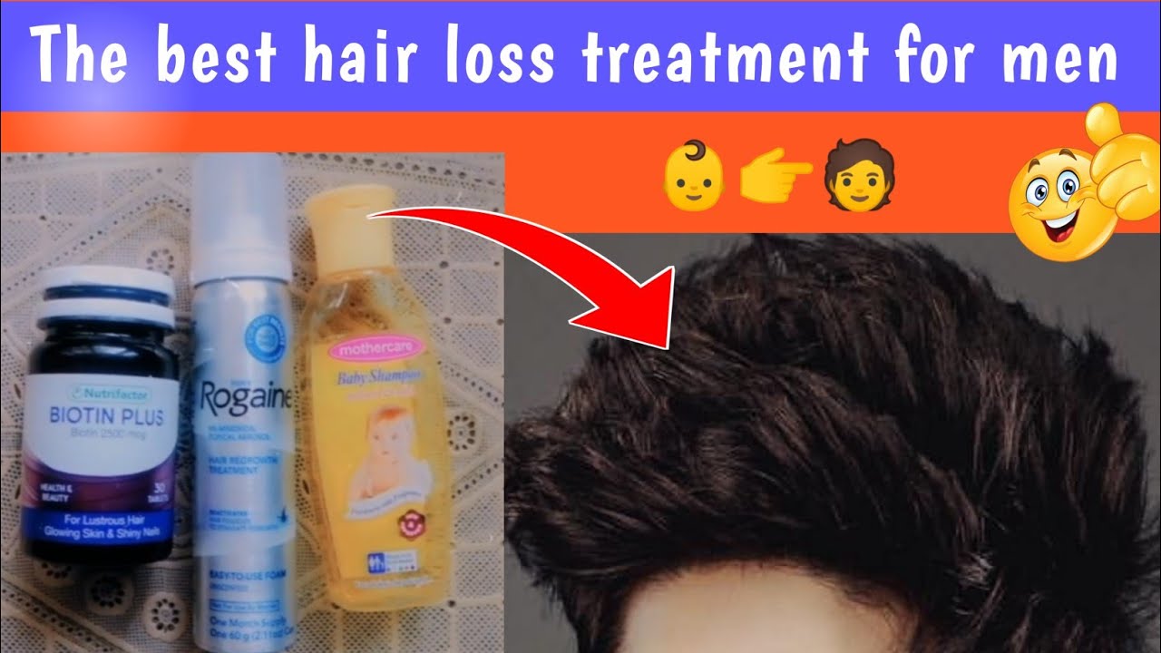 best hair loss treatment for men hair loss treatment for men in hindi