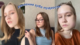 видео: удаление зуба мудрости // мой опыт картинка: удаление зуба мудрости // мой опыт