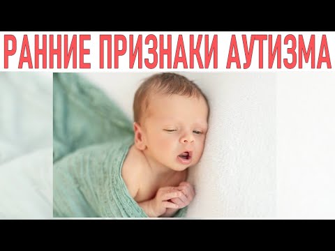 АУТИЗМ У ДЕТЕЙ | Признаки аутизма у детей младше 3 лет