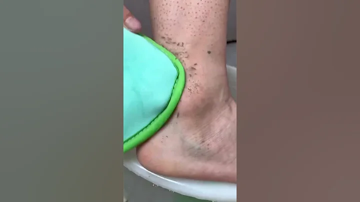 How to remove dead skin safely at home ( # 1556  ) 🛒 Gentle Touch Soft Dead Skin Remover Glove