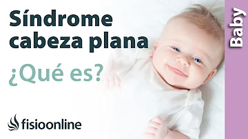 ¿Cuántos bebés tienen la cabeza plana?