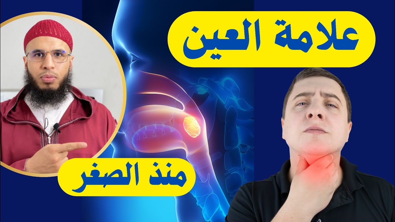  إنتبه...علامة العين منذ الصغر /الراقي أحمد السوسي 