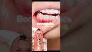 ЛАЙФХАК БЫСТРО УБРАТЬ ВОСПАЛЕНИЕ ДЕСЕН #зубы #уходзазубами #lifehacks