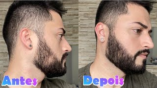 Pigmentação de barba com: Grecin 5 Barba e Bigode