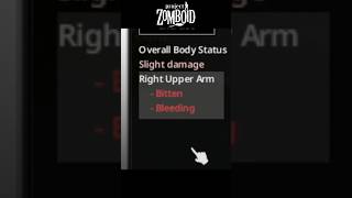 This Is The End... - Project Zomboid