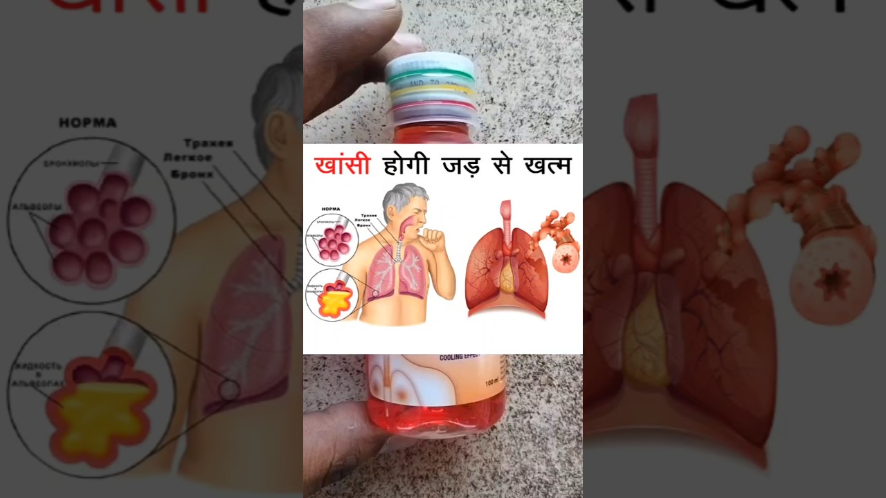 Bro-zedex syrup || Bro-zedex syrup ke fayde | Bro-zedex syrup uses in hindi | 