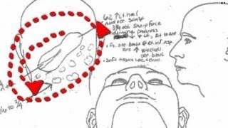 Trey Zwicker's autopsy shows brutality of murder