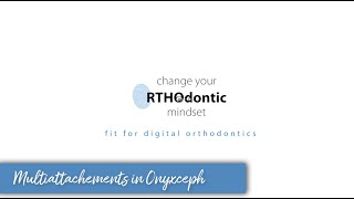 Onyx Aligner - Multiattachements