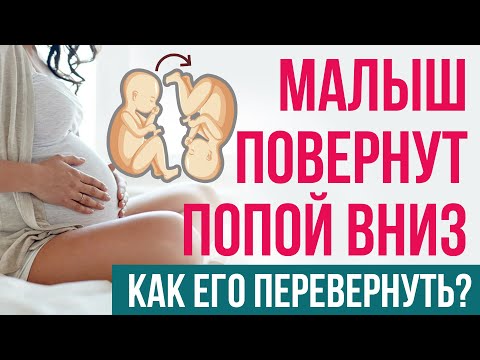 Тазовое предлежание: как перевернуть малыша безопасно?