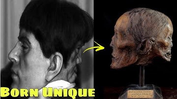 Edward Mordake: The Man With Two Faces 😯