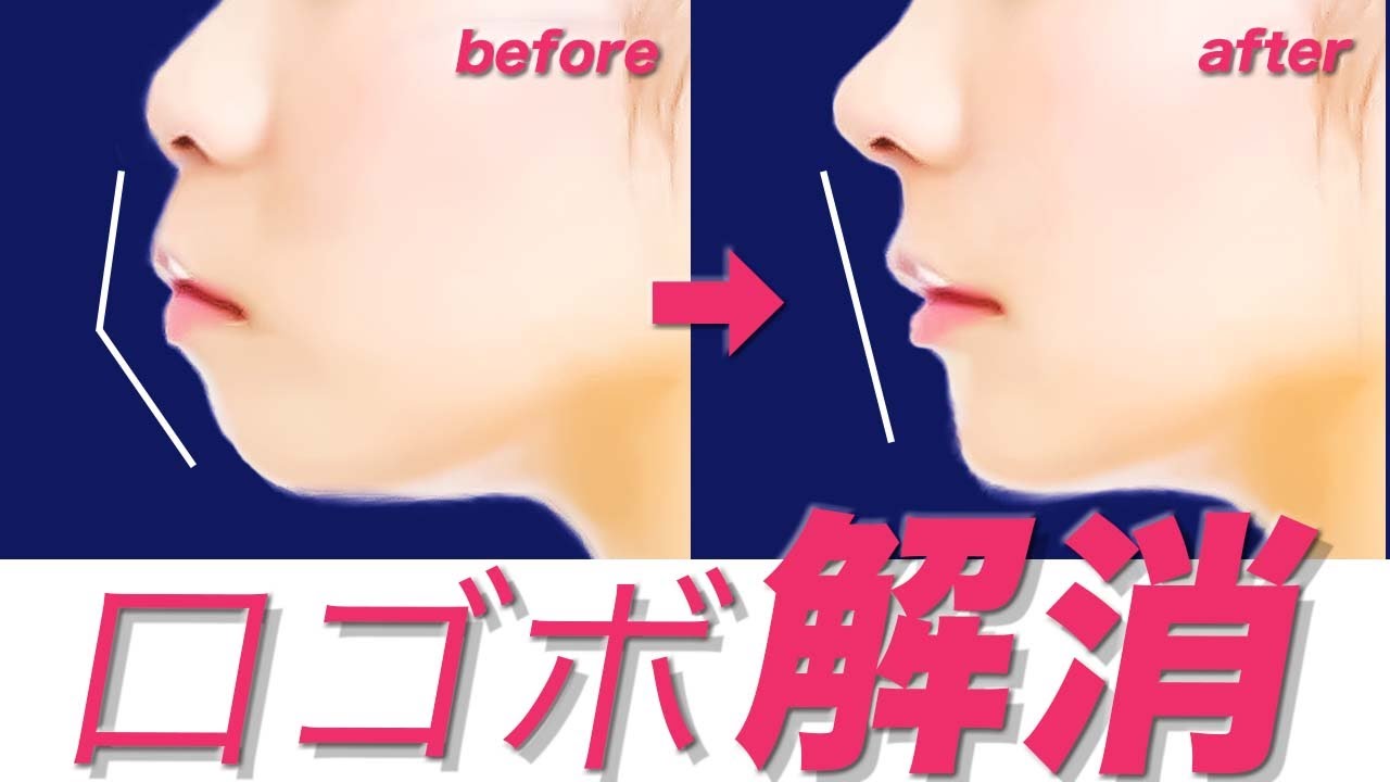 Orthodontic chimpanzee effect change mouth - YouTube