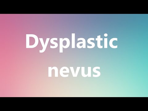 डिसप्लास्टिक नेवस - चिकित्सा परिभाषा और उच्चारण
