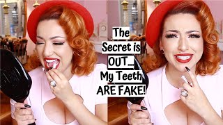 I have FAKE TEETH?! | Shiny Smile Veneers