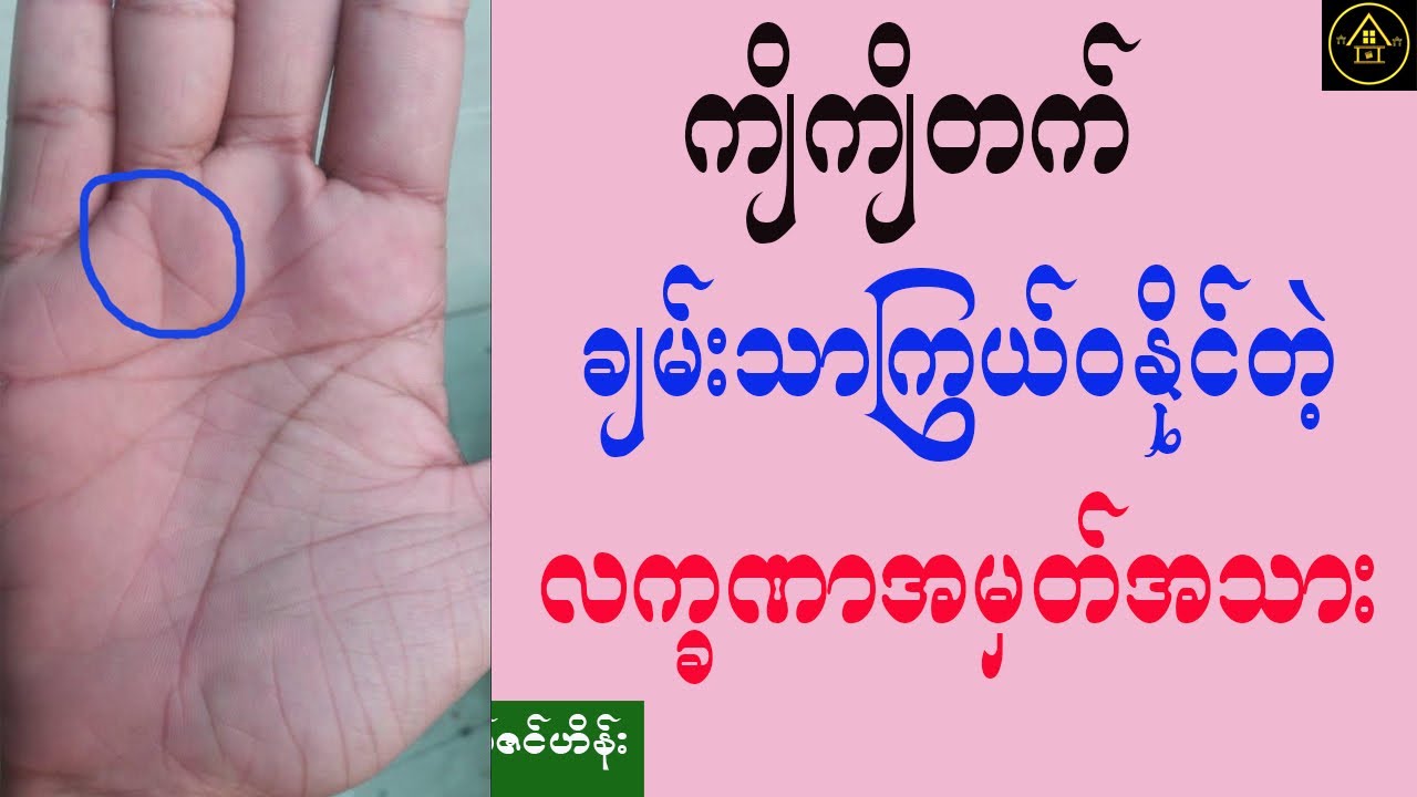 ကျိကျိတက် ကြွယ်ဝချမ်းသာနိုင်တဲ့ လက္ခဏာအမှတ်အသား