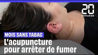 Mois sans tabac : On a testé l'acupuncture (dans l'oreille) pour arrêter de fumer