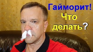 Лечение гайморита в домашних условиях. Гайморит как лечить народными средствами Лечение гайморита в домашних условиях. Гайморит как лечить народными средствами